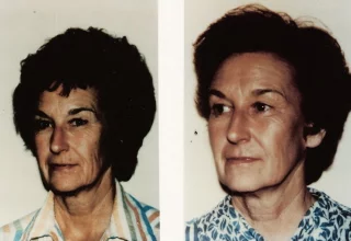 facial_ab_3_web.jpg